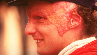 COTD: Niki Lauda Edition